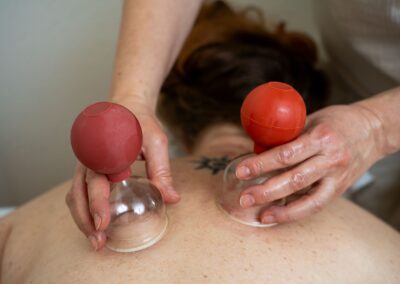 Schröpfmassage_dhania Naturheilkunde TEN_Naturheilpraxis Basel
